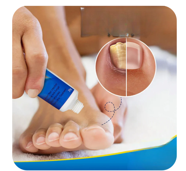 🔥 FUNGUS DERMAFIX PRO® – Restauración Total de Pies 👟